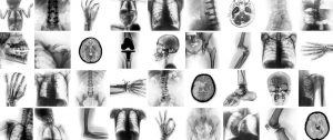 Collage image of many x-rays of human body parts