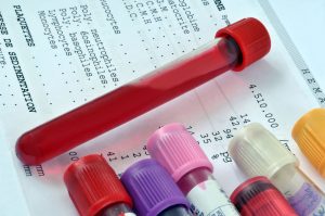 close-up photo of test tubes with fluids